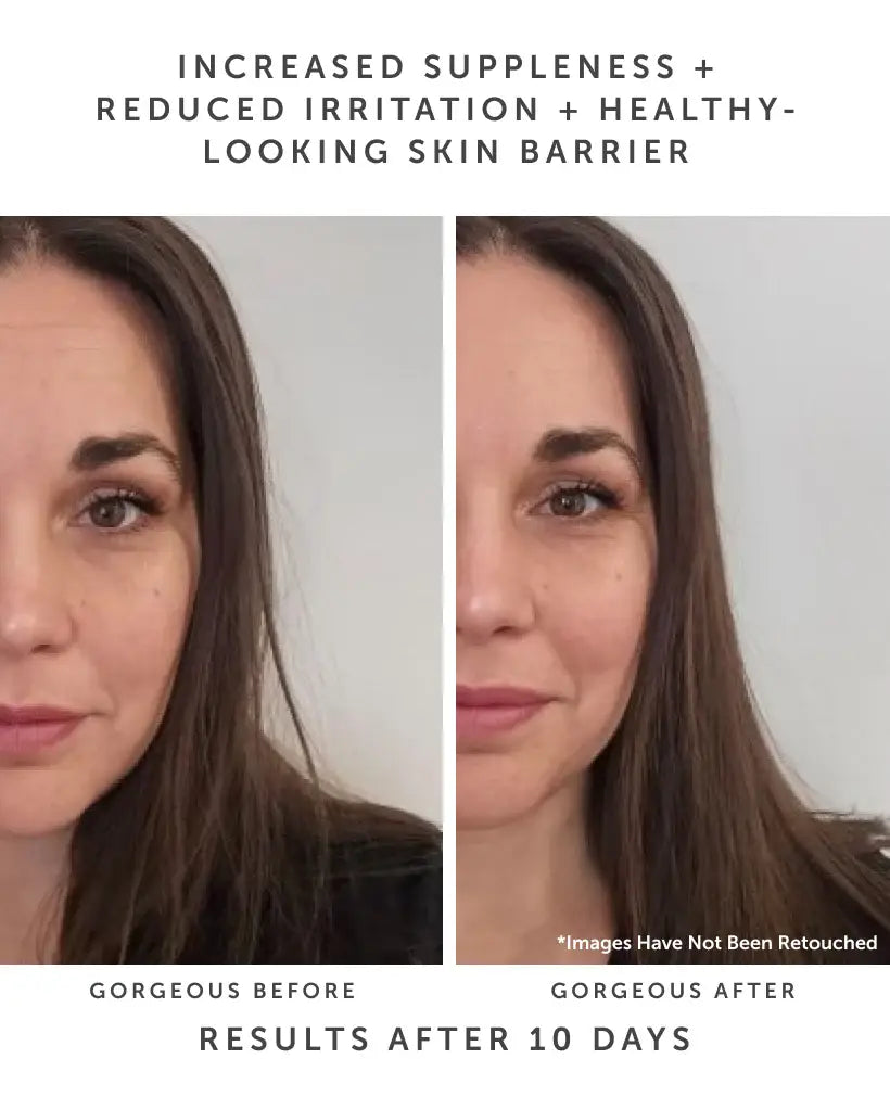 Earth Harbor Naturals - HORIZON Ceramide Repair Serum: Ceramide Complex